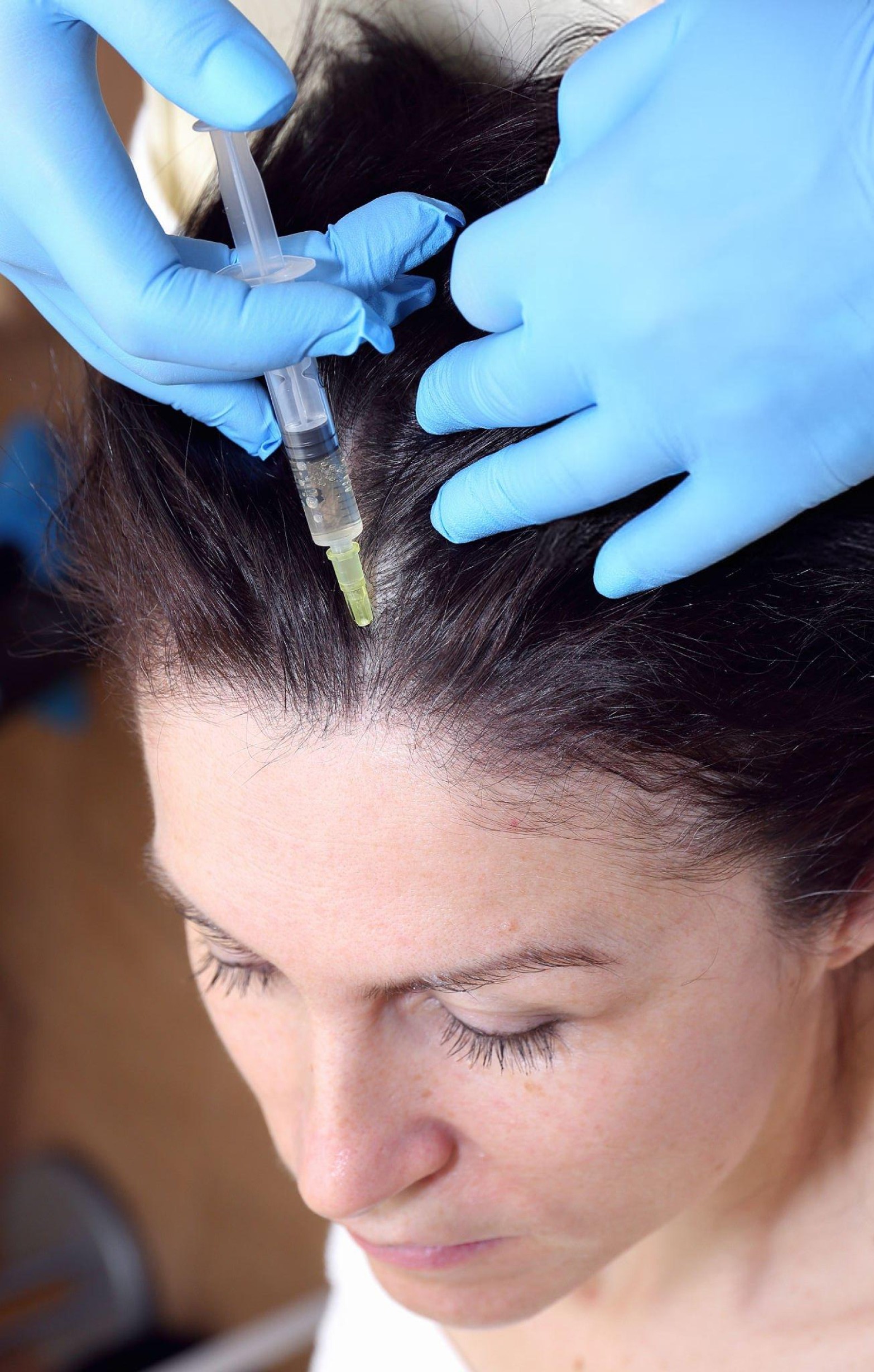 ExoSignal Hair treatment